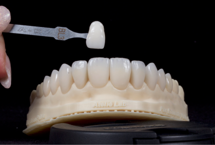 Harmonização Orofacial